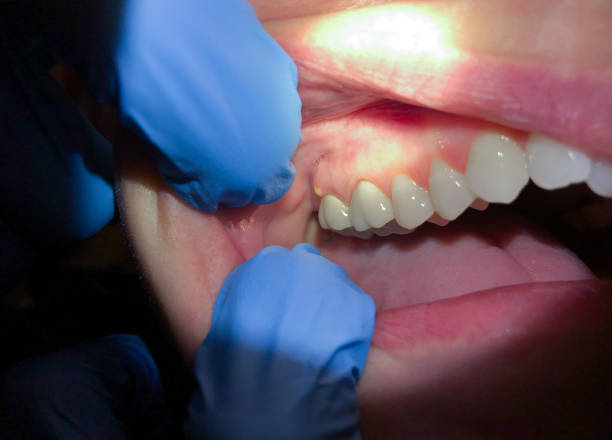 Urgent Tooth Repair in OR